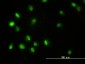STAT5B Antibody (monoclonal) (M01)